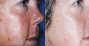 VitaminC_Hydrating-750x305 VitaminC_Hydrating-750x305